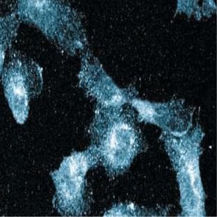 anti-BCL2-Associated Transcription Factor 1 (BCLAF1) (AA 318-439) antibody avatar