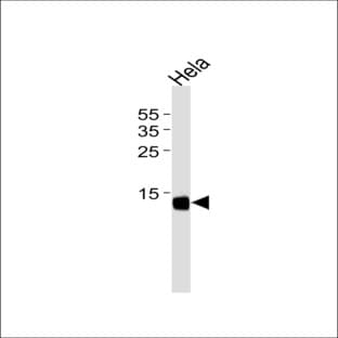 anti-Cytidine Deaminase (CDA) (Center) antibody avatar
