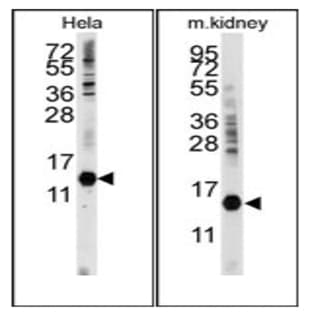 anti-Cytidine Deaminase (CDA) (C-Term) antibody avatar