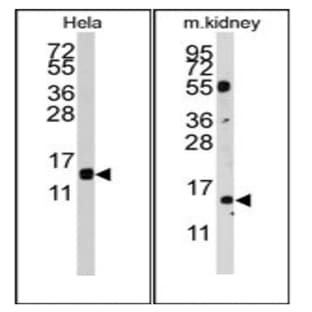 anti-Cytidine Deaminase (CDA) (AA 59-89) antibody avatar