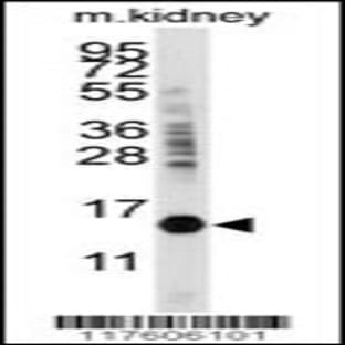 anti-Cytidine Deaminase (CDA) (C-Term), (AA 118-146) antibody avatar
