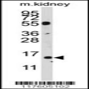 anti-Cytidine Deaminase (CDA) (AA 51-83), (Center) antibody avatar