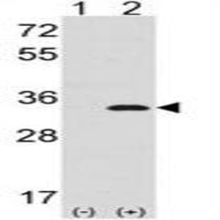 anti-Cyclin-Dependent Kinase 1 (CDK1) (N-Term) antibody avatar