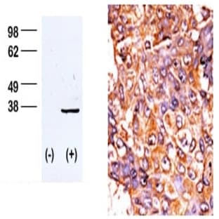 anti-Cyclin-Dependent Kinase 1 (CDK1) (pThr161) antibody avatar
