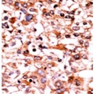 anti-Cyclin-Dependent Kinase 1 (CDK1) (pSer39) antibody avatar