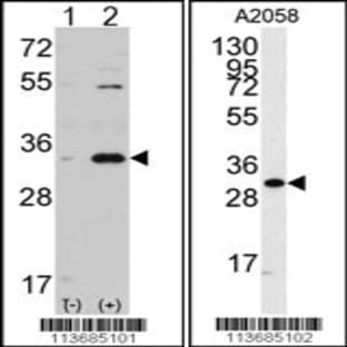 anti-Cyclin-Dependent Kinase 1 (CDK1) (C-Term), (AA 213-241) antibody avatar