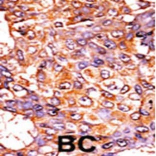 anti-Cyclin-Dependent Kinase 1 (CDK1) (pThr161) antibody avatar