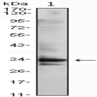 anti-Cyclin-Dependent Kinase 1 (CDK1) antibody avatar