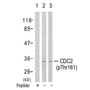 anti-Cyclin-Dependent Kinase 1 (CDK1) (pThr161) antibody avatar