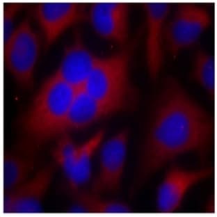 anti-Cyclin-Dependent Kinase 1 (CDK1) (Thr161) antibody avatar