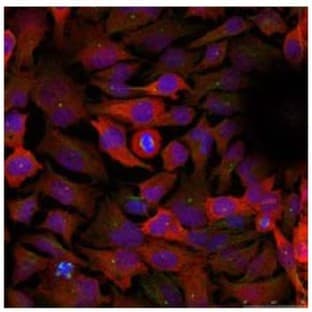 anti-Cyclin-Dependent Kinase 1 (CDK1) (Tyr 15) antibody avatar