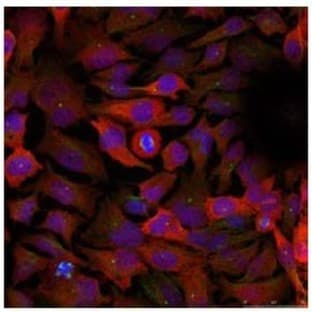 anti-Cyclin-Dependent Kinase 1 (CDK1) (Tyr 15) antibody avatar