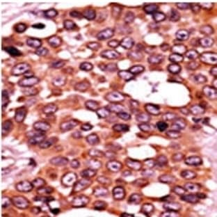 anti-Cell Division Cycle 6 Homolog (S. Cerevisiae) (CDC6) (pSer54) antibody avatar