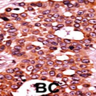 anti-Cell Division Cycle 6 Homolog (S. Cerevisiae) (CDC6) (pSer54) antibody avatar