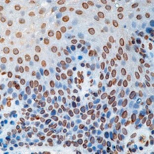 anti-Cell Division Cycle 25 Homolog A (S. Pombe) (CDC25A) antibody avatar