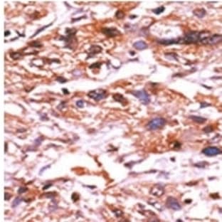 anti-Cell Division Cycle 25 Homolog A (S. Pombe) (CDC25A) (pSer124) antibody avatar