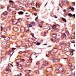 anti-Cell Division Cycle 25 Homolog A (S. Pombe) (CDC25A) (pSer279) antibody avatar