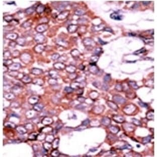 anti-Cell Division Cycle 25 Homolog A (S. Pombe) (CDC25A) (pSer76) antibody avatar