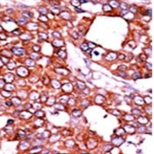 anti-Cell Division Cycle 25 Homolog A (S. Pombe) (CDC25A) (pThr507) antibody avatar