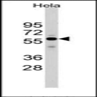 anti-Cell Division Cycle 25 Homolog A (S. Pombe) (CDC25A) (Middle Region) antibody avatar