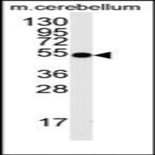 anti-Cell Division Cycle 25 Homolog A (S. Pombe) (CDC25A) (Ser78) antibody avatar