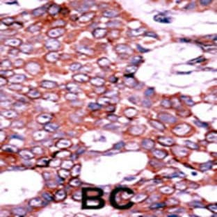 anti-Cell Division Cycle 25 Homolog A (S. Pombe) (CDC25A) (pSer75) antibody avatar