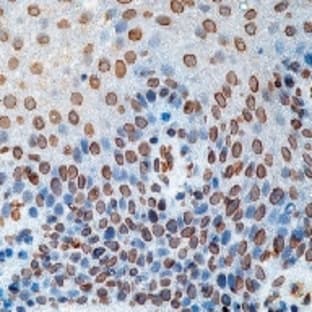 anti-Cell Division Cycle 25 Homolog A (S. Pombe) (CDC25A) antibody avatar