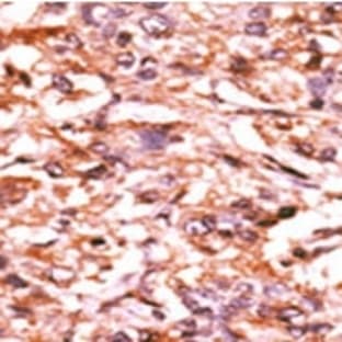 anti-Cell Division Cycle 25 Homolog B (S. Pombe) (CDC25B) (pSer187) antibody avatar