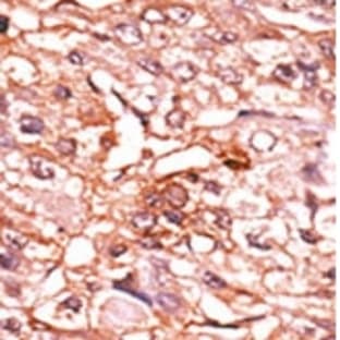 anti-Cell Division Cycle 25 Homolog B (S. Pombe) (CDC25B) (pSer353) antibody avatar