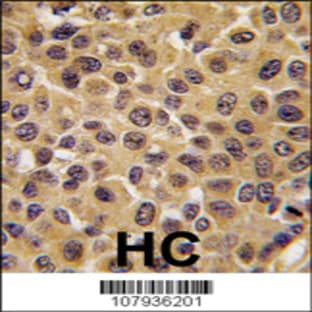 anti-Cell Division Cycle 25 Homolog B (S. Pombe) (CDC25B) (AA 331-360), (Center) antibody avatar