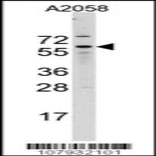 anti-Cell Division Cycle 25 Homolog B (S. Pombe) (CDC25B) (N-Term), (AA 165-194) antibody avatar