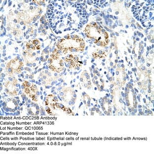 anti-Cell Division Cycle 25 Homolog B (S. Pombe) (CDC25B) (N-Term) antibody avatar