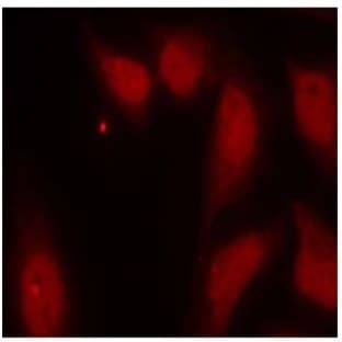 anti-Cell Division Cycle 25 Homolog C (S. Pombe) (CDC25C) (Ser216) antibody avatar