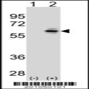 anti-Cell Division Cycle 25 Homolog C (S. Pombe) (CDC25C) antibody avatar