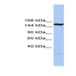 anti-CASP8 Associated Protein 2 (CASP8AP2) (N-Term) antibody