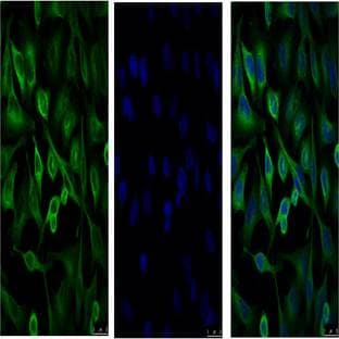 Anti-?-Tubulin Monoclonal Antibody (3G5) avatar