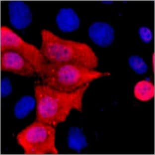 Anti-His Tag Mouse Monoclonal Antibody (5C3) avatar