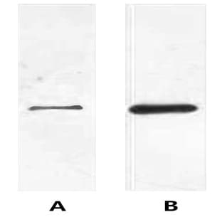 Anti-His Tag Rabbit Polyclonal Antibody avatar