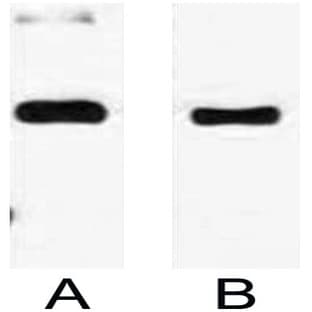 Anti-Trx Tag Mouse Monoclonal Antibody (14D4) avatar