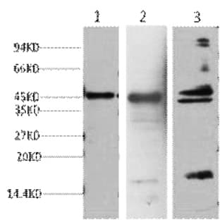 Aquaporin 4 Monoclonal Antibody avatar