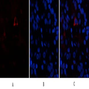 AR Polyclonal Antibody avatar
