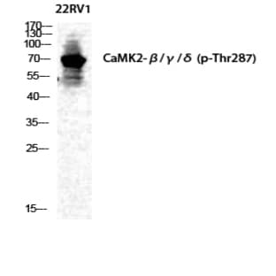 CaMKII?/?/? (phospho Thr287) Polyclonal Antibody avatar