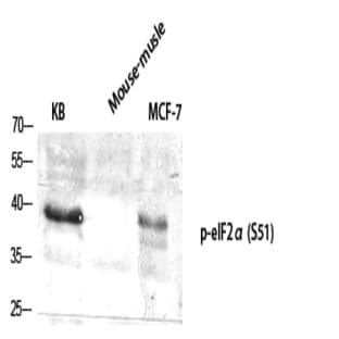 eIF2? (phospho Ser51) Polyclonal Antibody avatar
