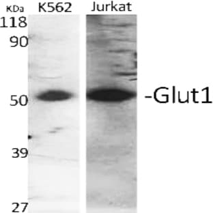 Glut1 Polyclonal Antibody avatar