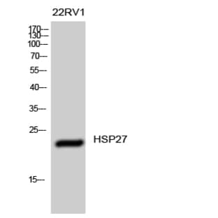 HSP27 Polyclonal Antibody avatar