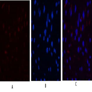 JAK3 Polyclonal Antibody avatar