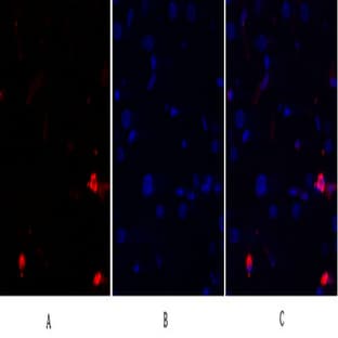 JNK1/2/3 Polyclonal Antibody avatar
