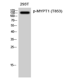 MYPT1 (phospho Thr853) Polyclonal Antibody avatar