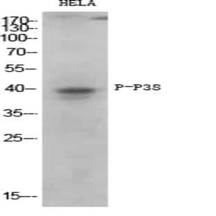 p38 (phospho Thr180/Y182) Polyclonal Antibody avatar