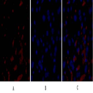 Raf-1 Polyclonal Antibody avatar